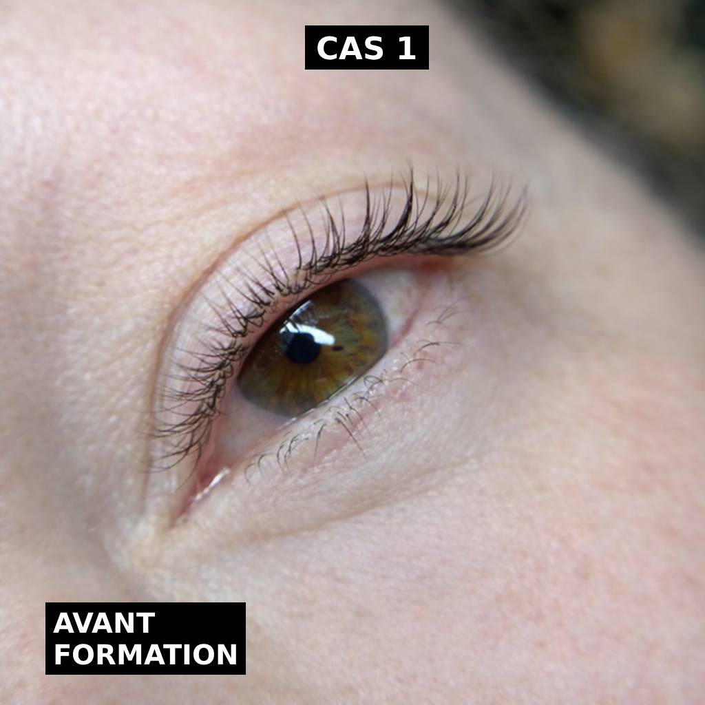 Cas 1 avant formation
