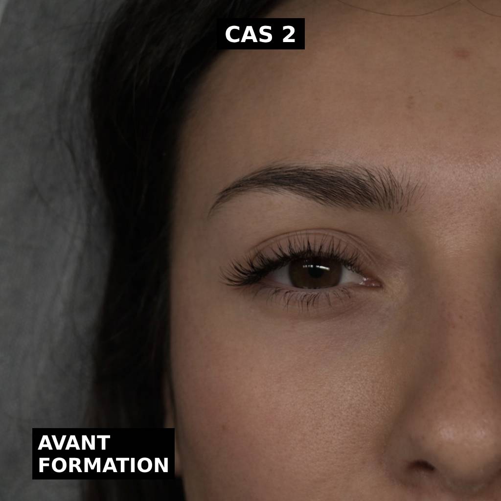 Cas 2 avant formation