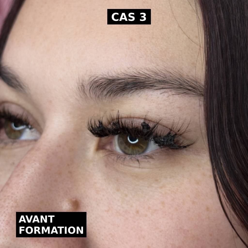 Cas 3 avant formation